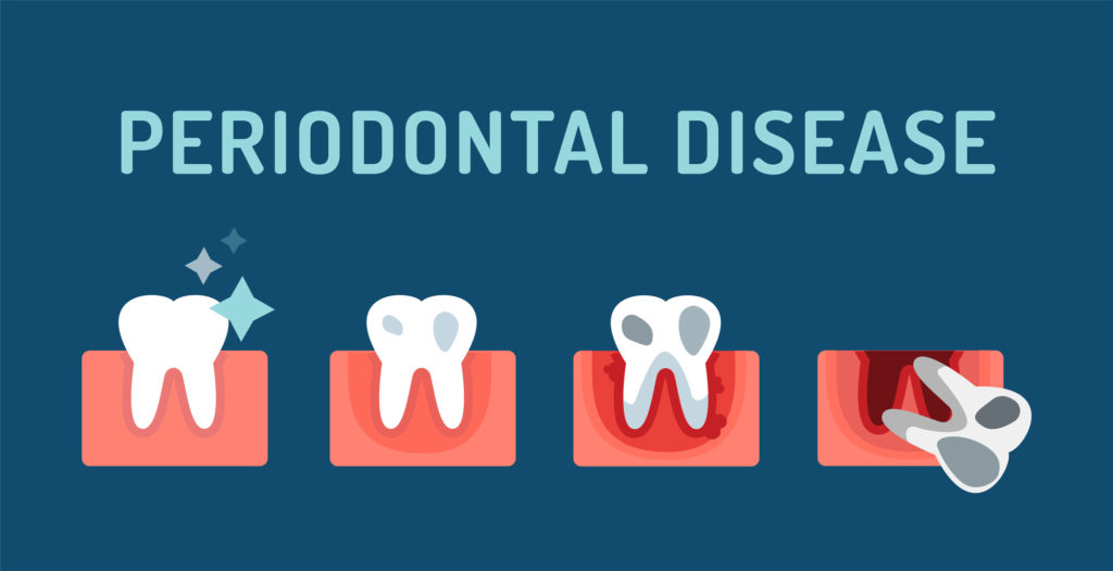 Great Gum Care Periodontists Explained