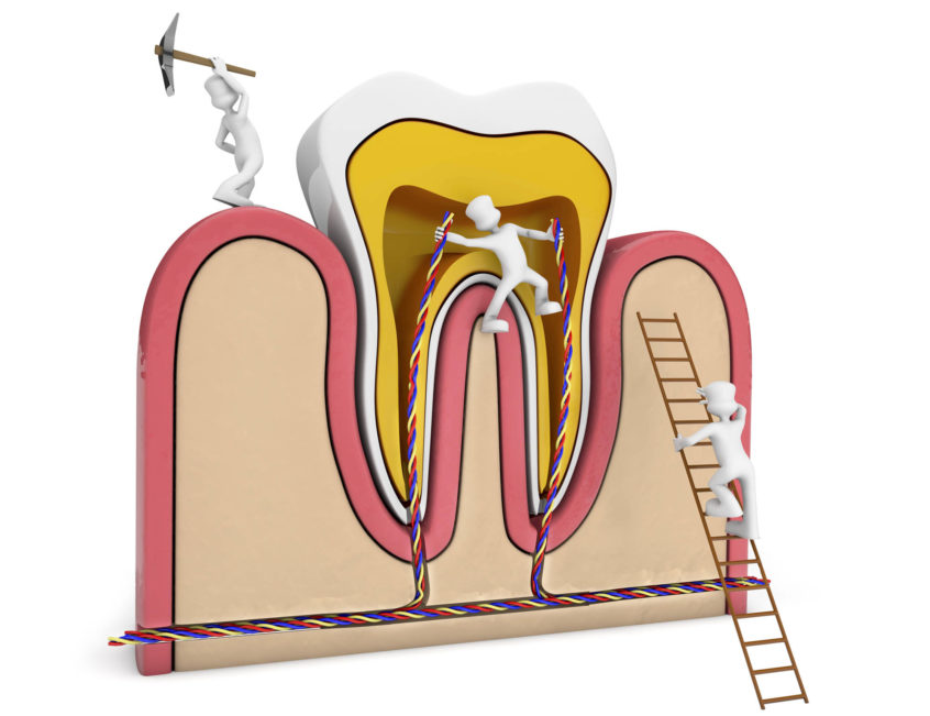 root canal therapy towson
