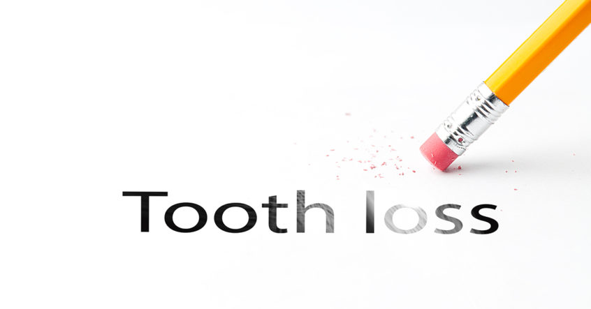 what to do about tooth loss