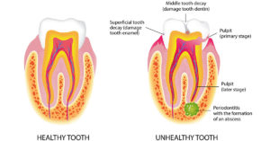 effective gum disease treatment